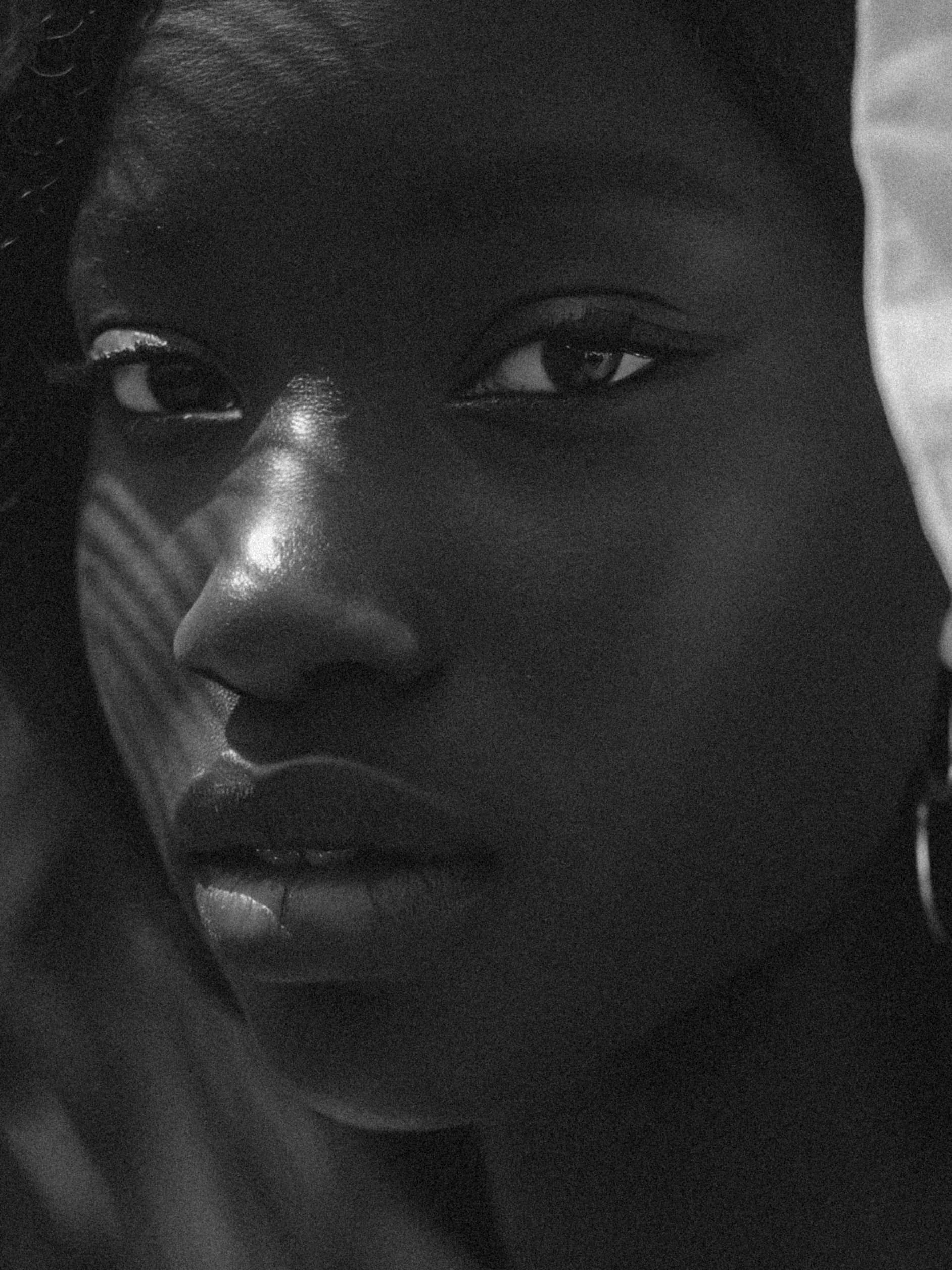 Refined facial features reflecting natural Botox results in Edmonds WA